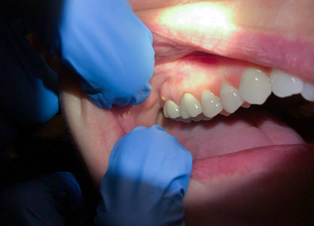 Best Urgent Tooth Repair  in Baileys Crossroads, VA