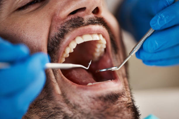 Best Emergency Tooth Extraction  in Baileys Crossroads, VA