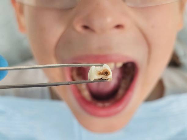Best Dental Emergency Near Me  in Baileys Crossroads, VA
