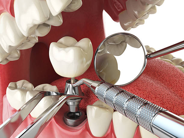 Best Broken Tooth Emergency  in Baileys Crossroads, VA